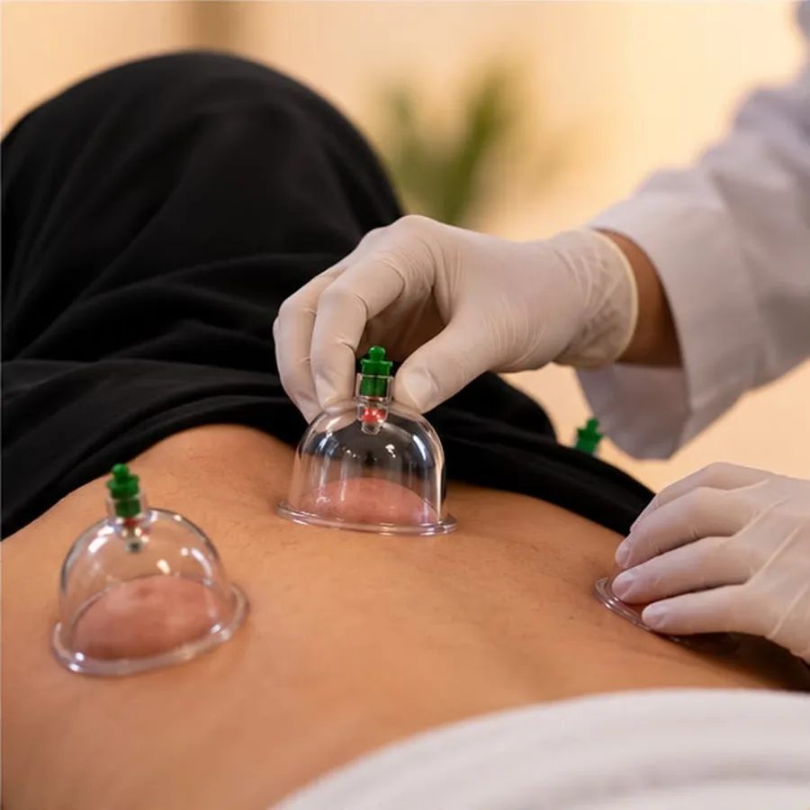 Medical cupping session